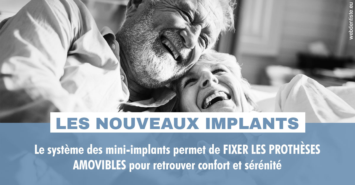 https://www.drigalnahmias.fr/Les nouveaux implants 2