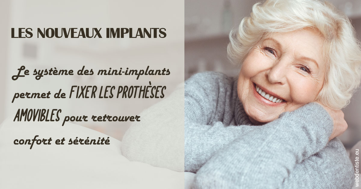 https://www.drigalnahmias.fr/Les nouveaux implants 1