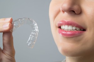 La technique Invisalign® Align Technology