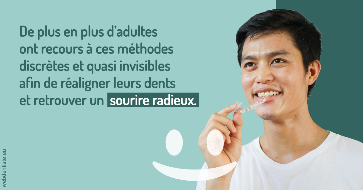 https://www.drigalnahmias.fr/Gouttières sourire radieux 2