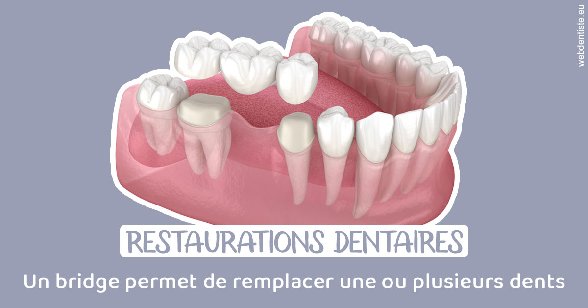 https://www.drigalnahmias.fr/Bridge remplacer dents 1