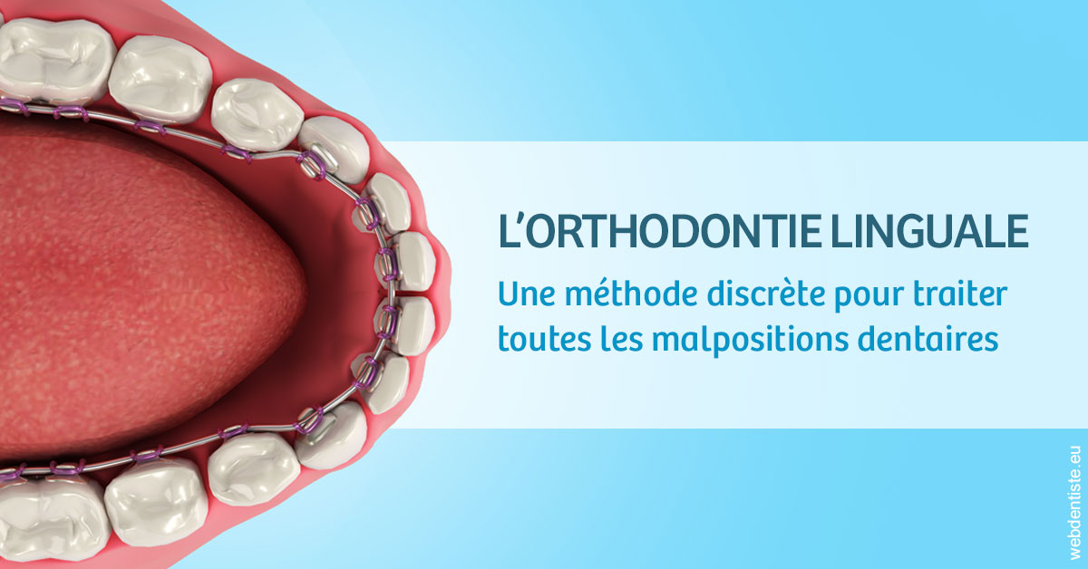 https://www.drigalnahmias.fr/L'orthodontie linguale 1