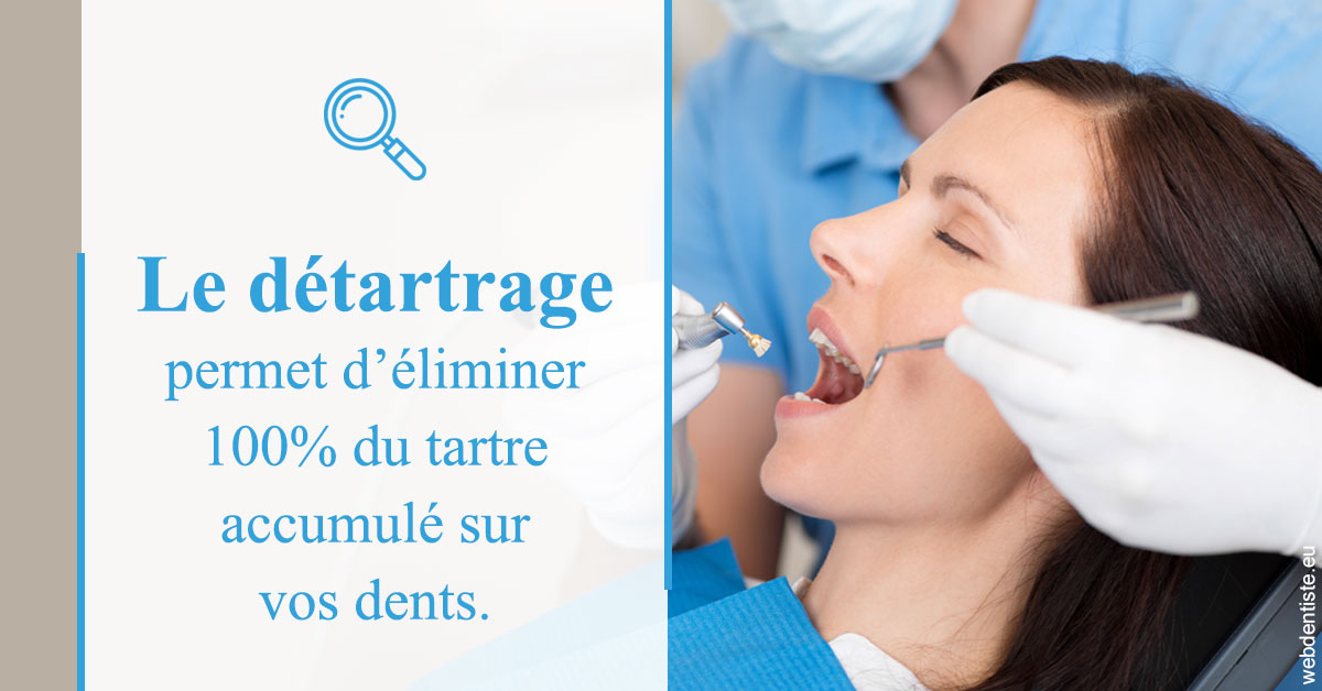 https://www.drigalnahmias.fr/En quoi consiste le détartrage