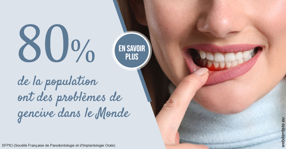https://www.drigalnahmias.fr/Problèmes de gencive 2