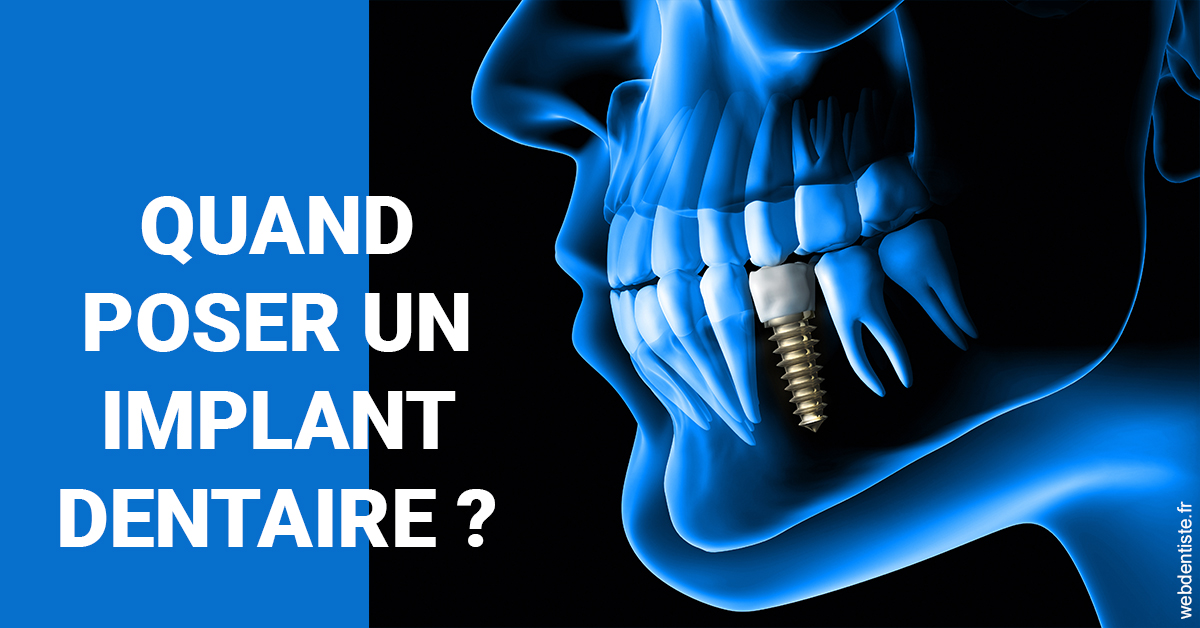https://www.drigalnahmias.fr/Les implants 1
