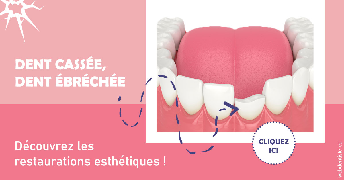 https://www.drigalnahmias.fr/Dent cassée ébréchée 1
