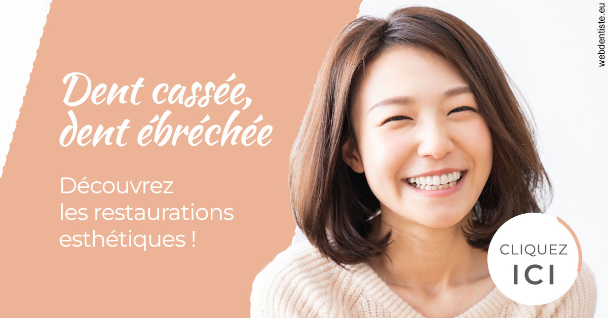 https://www.drigalnahmias.fr/Dent cassée ébréchée 2