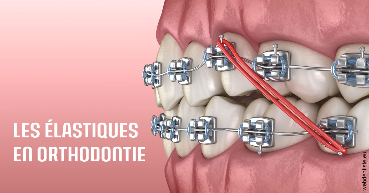 https://www.drigalnahmias.fr/Elastiques orthodontie 2