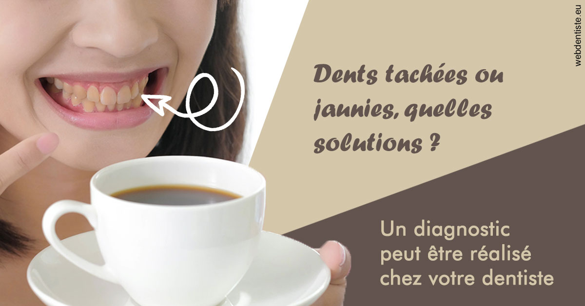 https://www.drigalnahmias.fr/Dents tachées 1
