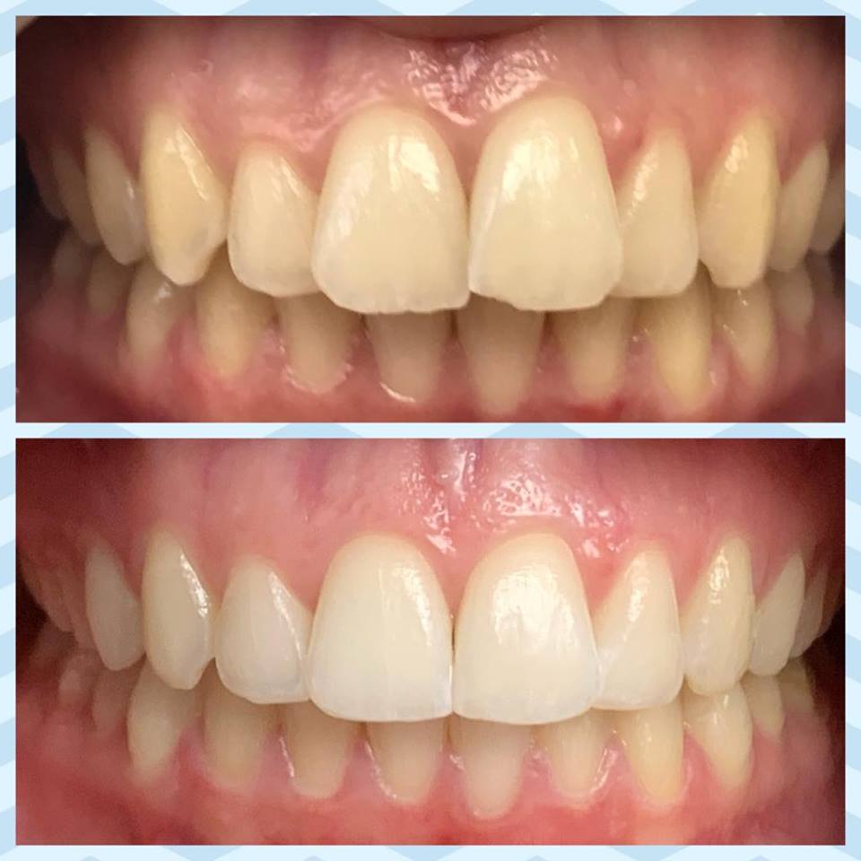cas clinique 9