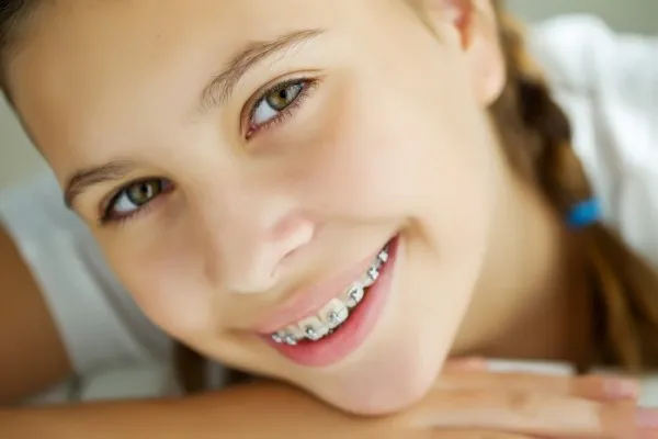 Jeune fille sourire bagues
